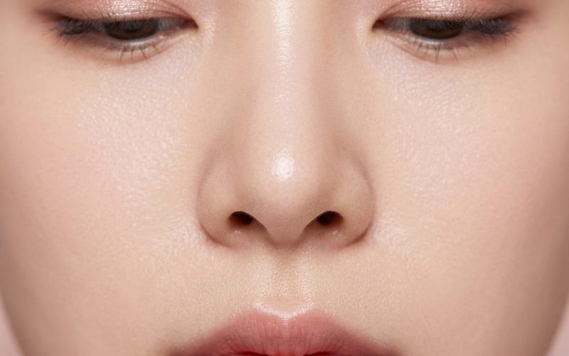 비공내리기 콧구멍성형 로코코성형외과