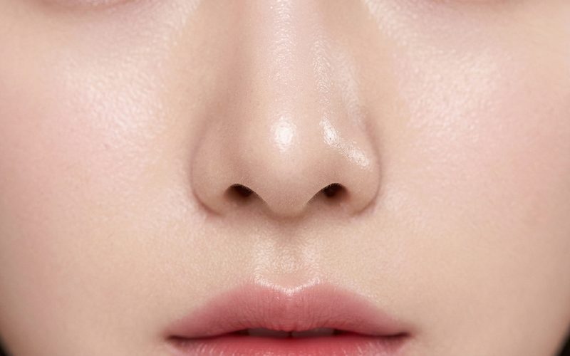 기증진피 (메가덤, 알로덤) 이용한 비공내리기 수술에 대해